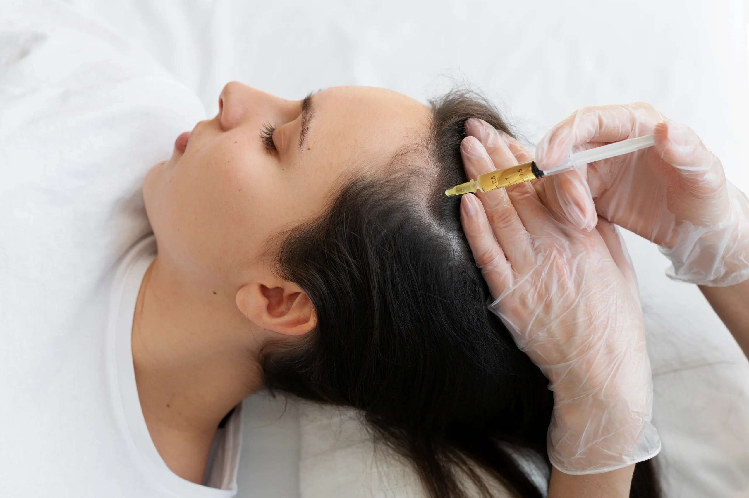 Person receiving scalp injection with a syringe by hands wearing clear medical gloves, lying on a white surface.